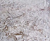  ���A ����ʯ ���ϴ��Ƚ���FY-08 ��20mm 